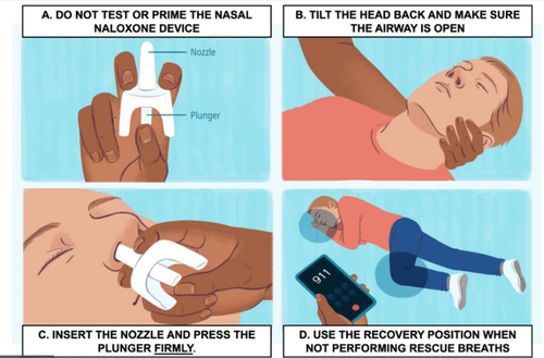 Narcan steps